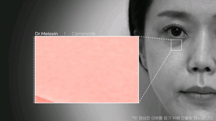 솔루션 제시하고 끝? 이어지는 애프터 샷으로 효능 전달