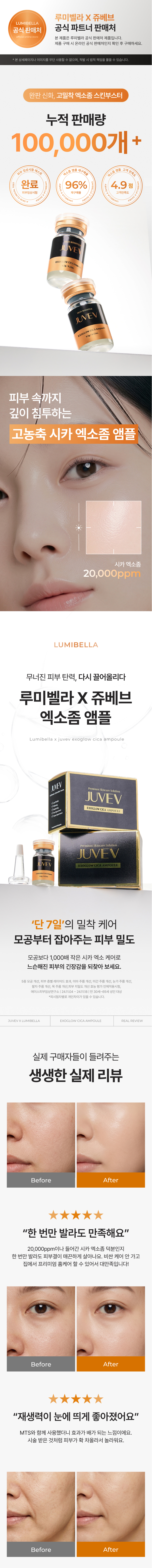 시카 엑소좀 앰플 화장품 상세페이지 1번 섹션