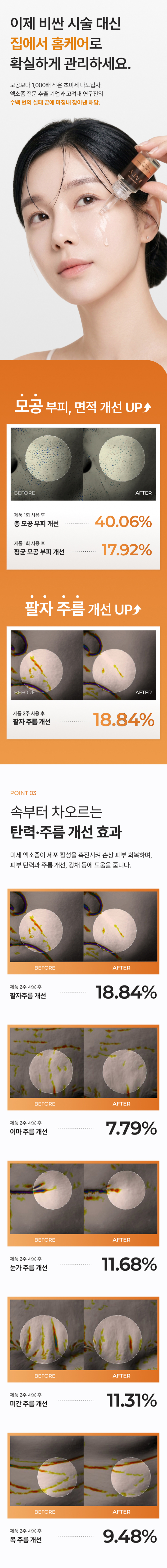 시카 엑소좀 앰플 화장품 상세페이지 3번 섹션